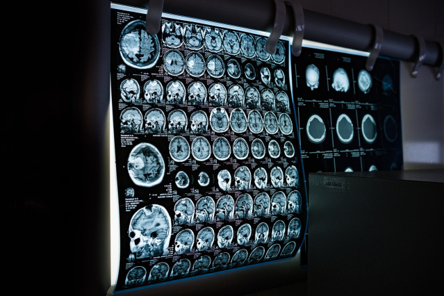 mri brain imaging